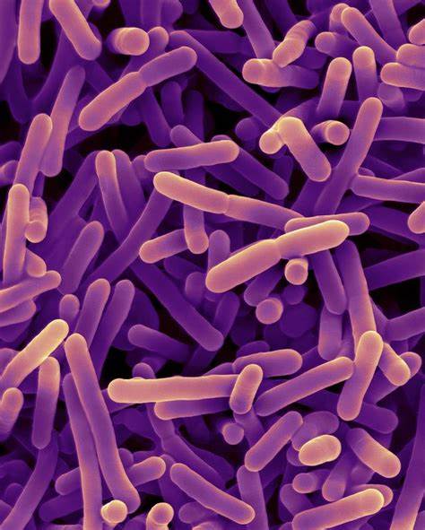 Bifidobacterium Longum